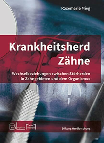 Krankheitsherd Zähne: Wechselbeziehungen zwischen Störherden in Zahngebieten und dem Organismus