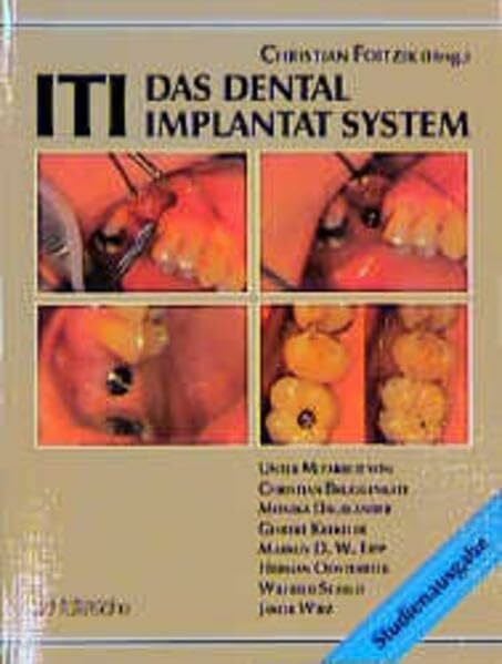 ITI - Das Dental-Implantat-System: Studienausgabe
