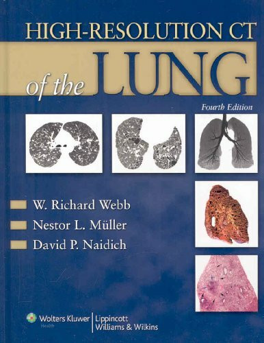 High-Resolution CT of the Lung