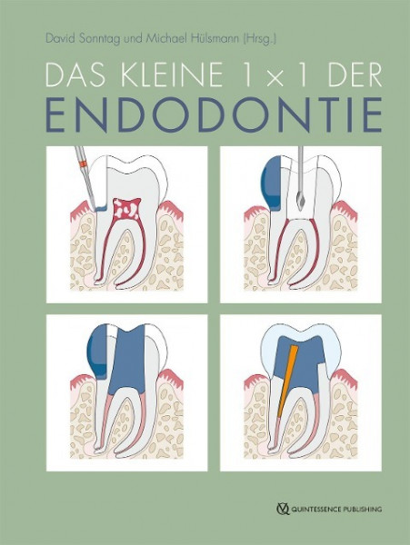 Das kleine 1x1 der Endodontie