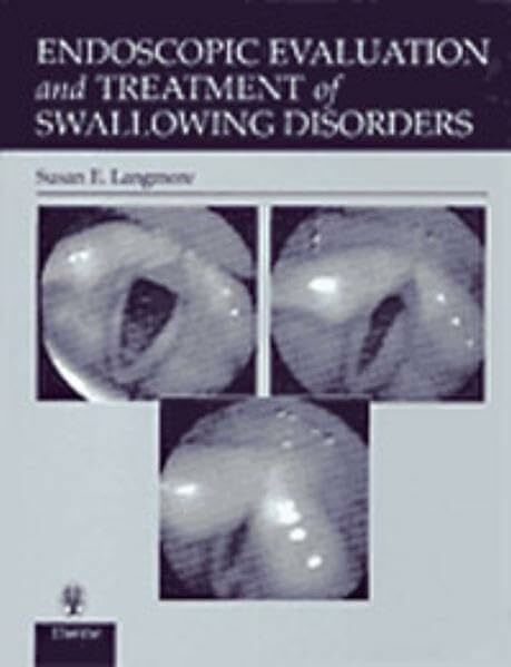 Endoscopic Evaluation and Treatment of Swallowing Disorders