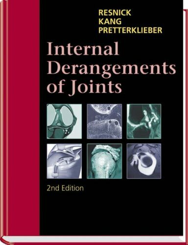 Internal Derangements of Joints, 2 Vols.: Vol. I an Vol. II
