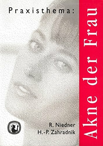 Akne der Frau