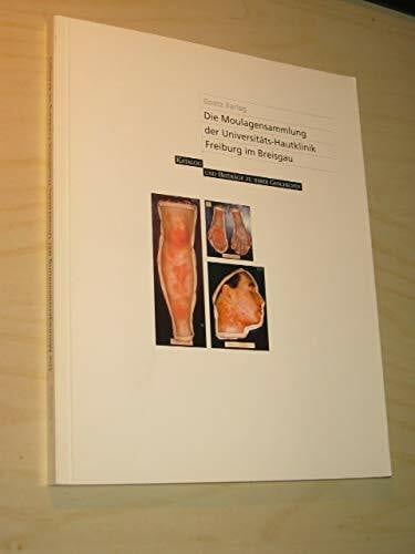 Die Moulagensammlung der Universitätshautklinik Freiburg im Breisgau: Katalog und Beiträge zu ihrer Geschichte