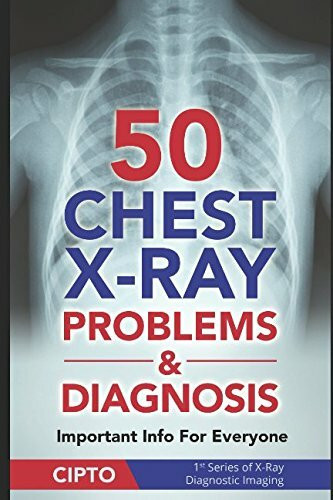 50 Chest X-Ray Problems & Diagnosis: Important Info For Everyone (X-Ray Diagnostic Imaging, Band 1)