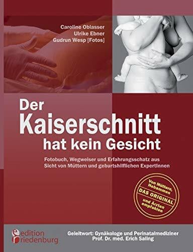 Der Kaiserschnitt hat kein Gesicht