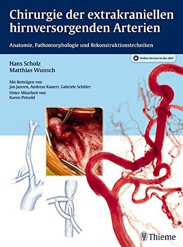 Chirurgie der extrakraniellen hirnversorgenden Arterien: Anatomie, Pathomorphologie und Rekonstruktionstechniken. Plus Online-Version in der eRef