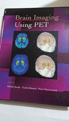 Brain Imaging Using PET