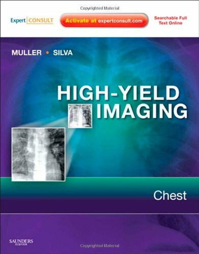Chest: Expert Consult - Online and Print (HIGH YIELD in Radiology)