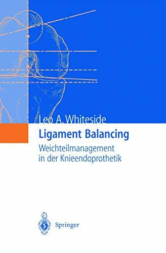 Ligament Balancing: Weichteilmanagement in der Knieendoprothetik