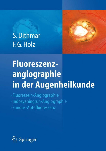 Fluoreszenzangiographie in der Augenheilkunde: Fluoreszein-Angiographie, Indozyaningrün-Angiographie und Fundus-Autofluoreszenz