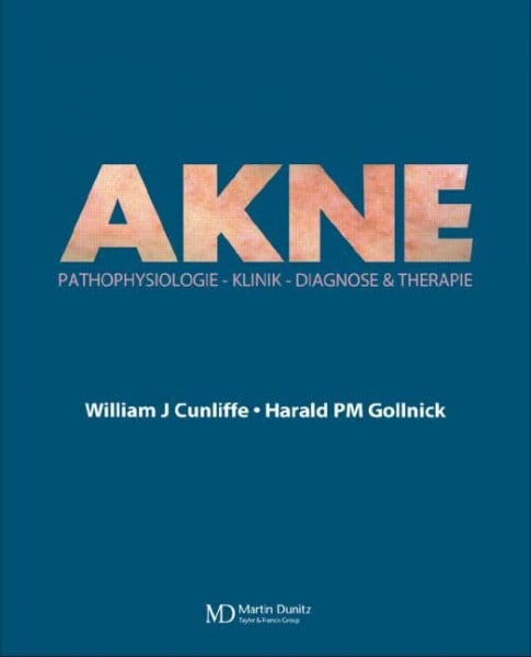 Acne: Diagnose und Therapie