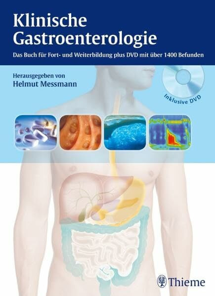 Klinische Gastroenterologie: Das Buch für Fort- und Weiterbildung plus DVD mit über 1.000 Befunden: Das Buch für Fort- und Weiterbildung mit über 1400 Befunden