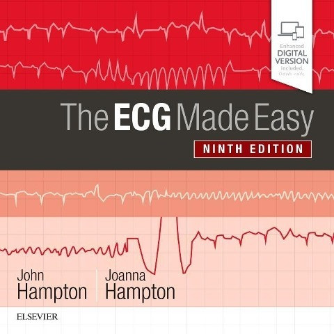 ECG made easy