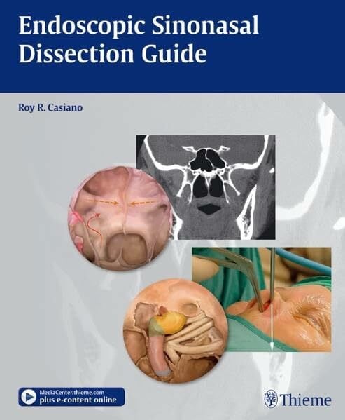Endoscopic Sinonasal Dissection Guide: With E-Book