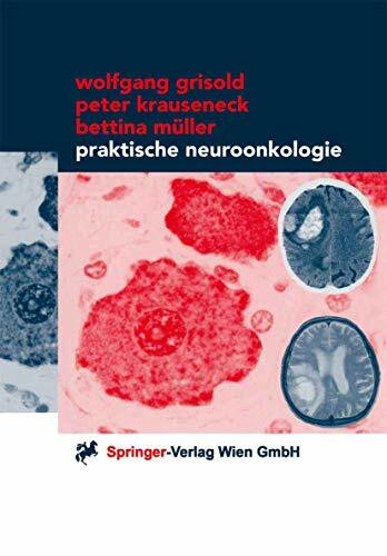 Praktische Neuroonkologie (German Edition)
