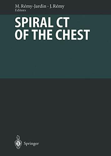 Spiral CT of the Chest: With Contributions by Numerous Experts (Diagnostic Imaging)