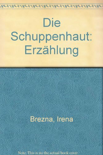 Die Schuppenhaut: Erzählung