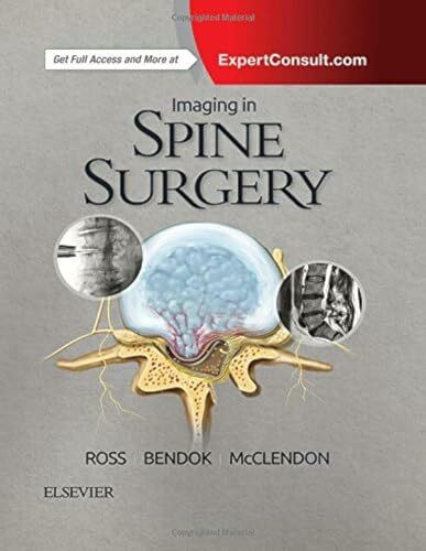 Imaging in Spine Surgery