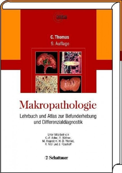 Makropathologie