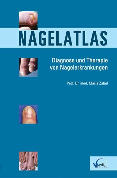 Nagelatlas: Diagnose und Therapie von Nagelerkrankungen