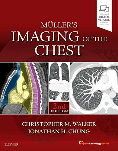 Elsevier Muller's Imaging Of The Chest, Expert Radiology Series