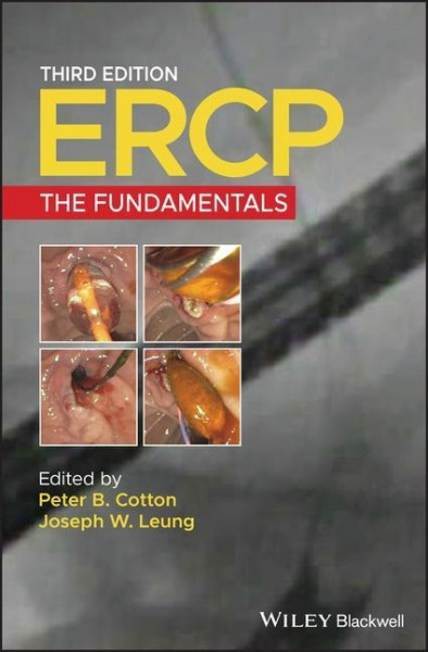 Ercp: The Fundamentals