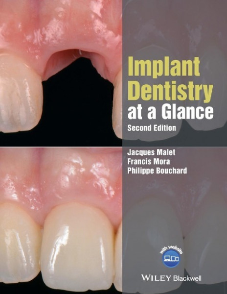 Implant Dentistry at a Glance, Second Edition