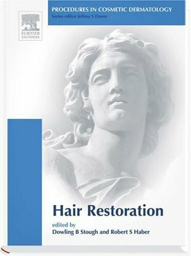 Hair Transplantation. Procedures in Cosmetic Dermatology Series (Procedures in Cosmetic Dermatology)