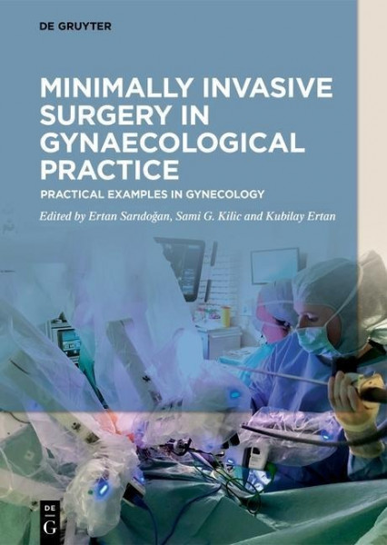 Minimally Invasive Surgery in Gynecological Practice