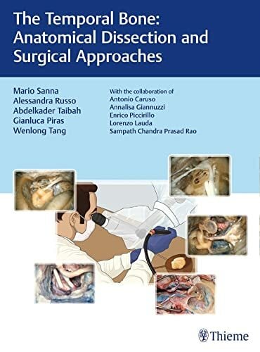The Temporal Bone: Anatomical Dissection and Surgical Approaches The Temporal Bone: Anatomical Dissection and Surgical Approaches