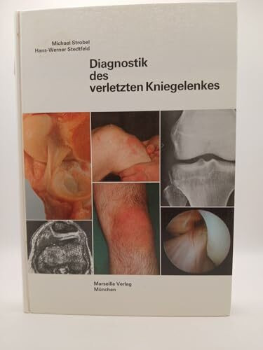Diagnostik des verletzten Kniegelenkes