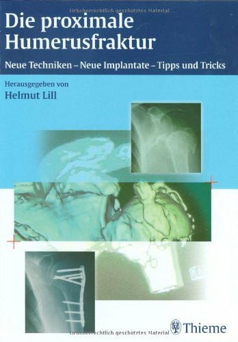Die proximale Humerusfraktur: Neue Techniken, neue Implantate - Tipps und Tricks