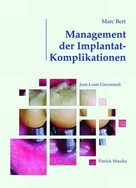 Management der Implantat-Komplikationen