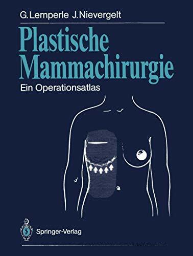 Plastische Mammachirurgie: Ein Operationsatlas Plastische Mammachirurgie: Ein Operationsatlas
