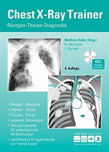 Chest-X-Ray Trainer: Röntgen-Thorax-Bildinterpretation