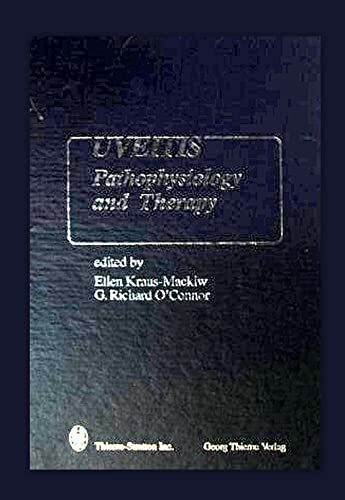 Uveitis