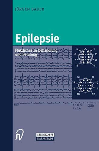 Epilepsie. Nützliches zu Behandlung und Beratung