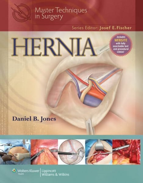 Hernia (Master Techniques in Surgery)