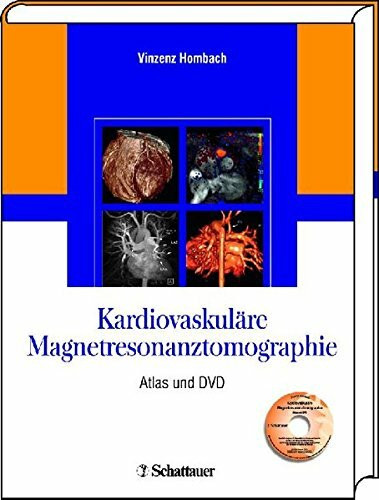 Kardiovaskuläre Magnetresonanztomographie: Atlas und DVD
