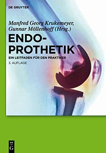 Endoprothetik: Ein Leitfaden für den Praktiker