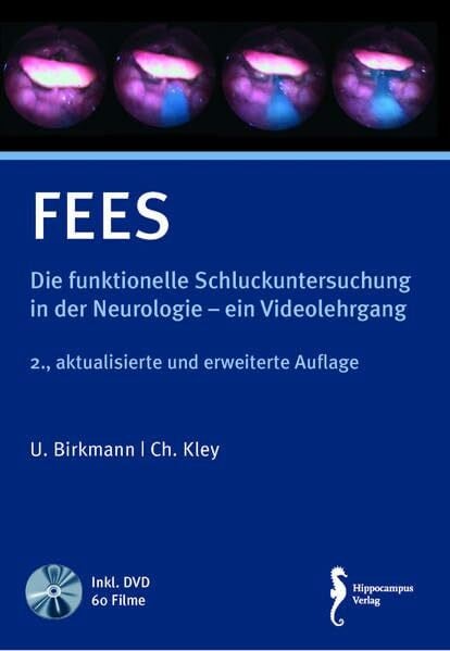 FEES: Die funktionelle Schluckuntersuchung in der Neurologie – Ein Videolehrgang