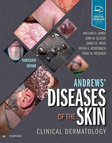Andrews' Diseases of the Skin: Clinical Dermatology Andrews' Diseases of the Skin: Clinical Dermatology