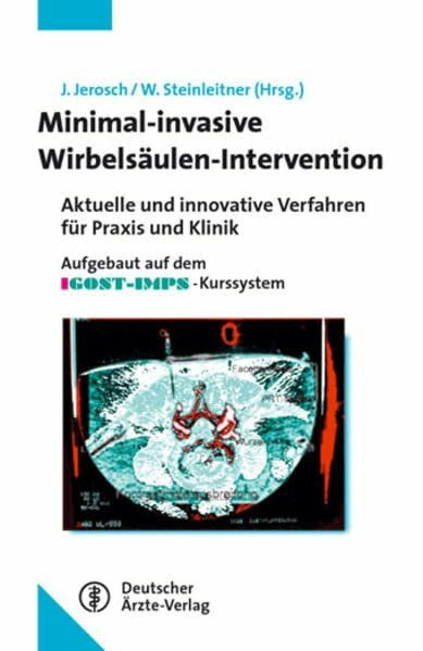 Minimalinvasive Wirbelsäulen-Intervention: Aktuelle und innovative Verfahren für Praxis und Klinik Aufgebaut auf dem IGOST-IMPS-Kurssystem