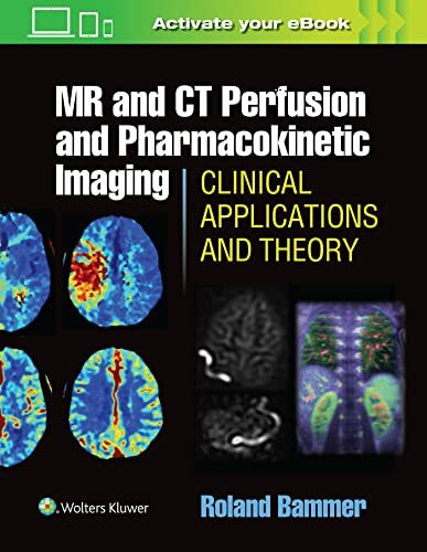 MR & CT Perfusion Imaging: Clinical Applications and Theoretical Principles
