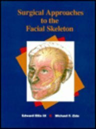 Surgical Approaches to the Facial Skeleton