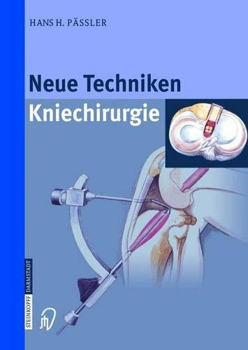 Neue Techniken - Kniechirurgie