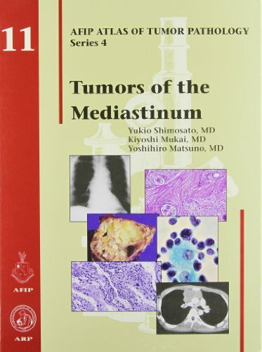 TUMORS OF THE MEDIASTINUM (AFIP Atlas of Tumor Pathology, Series 4,)