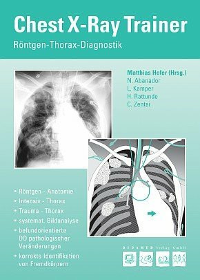 Chest-X-Ray-Trainer: Röntgen-Thorax-Diagnostik