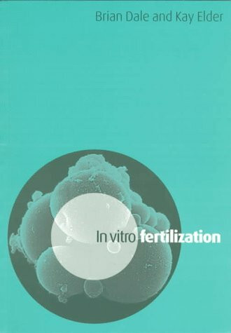 In Vitro Fertilization